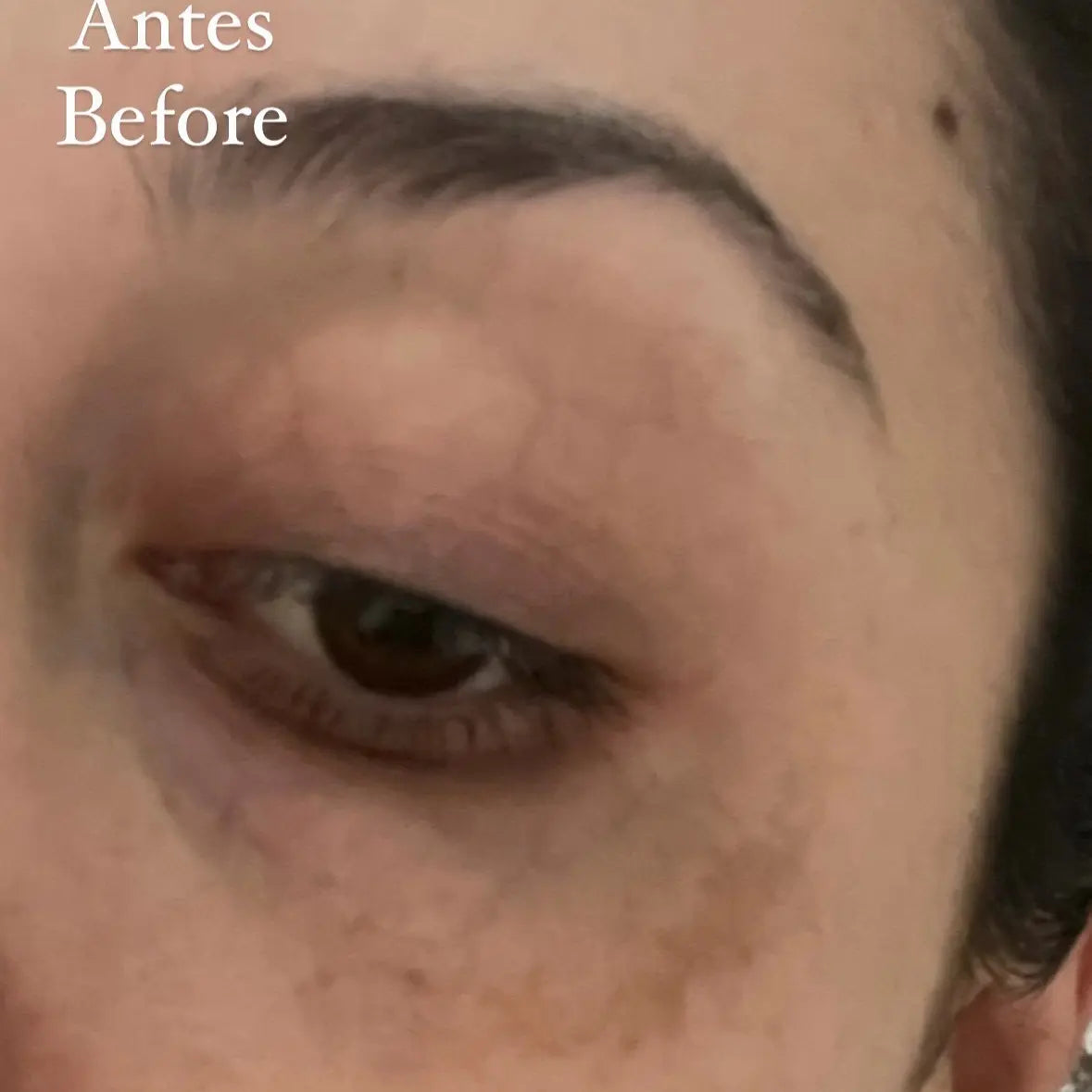 Vitamin C Serum JC SKIN