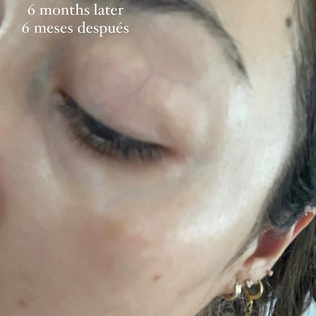 Vitamin C Serum JC SKIN