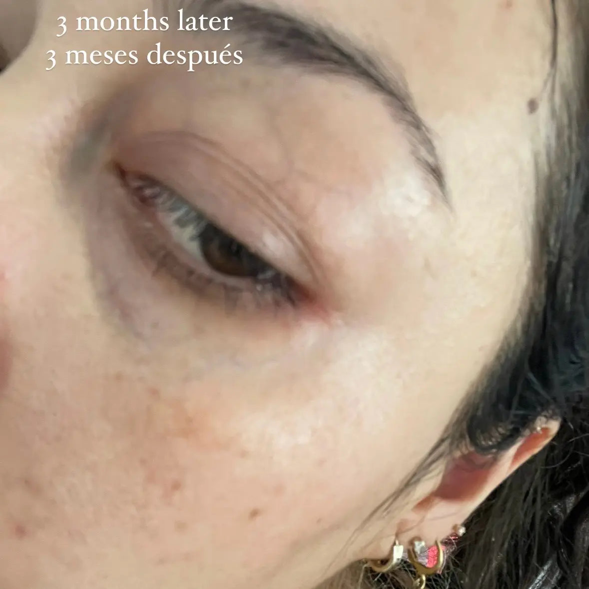 Vitamin C Serum JC SKIN